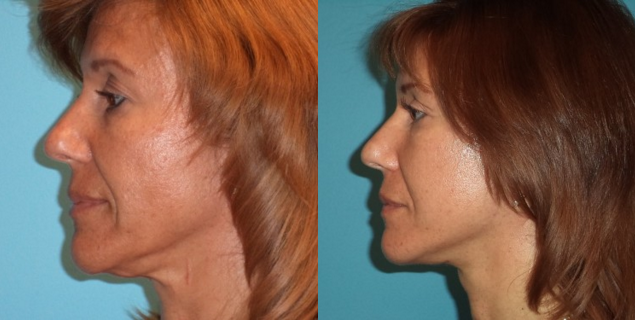 What Facial Correction Do I Need? - Featured Image