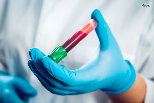 blood test in techs hands-img-blog