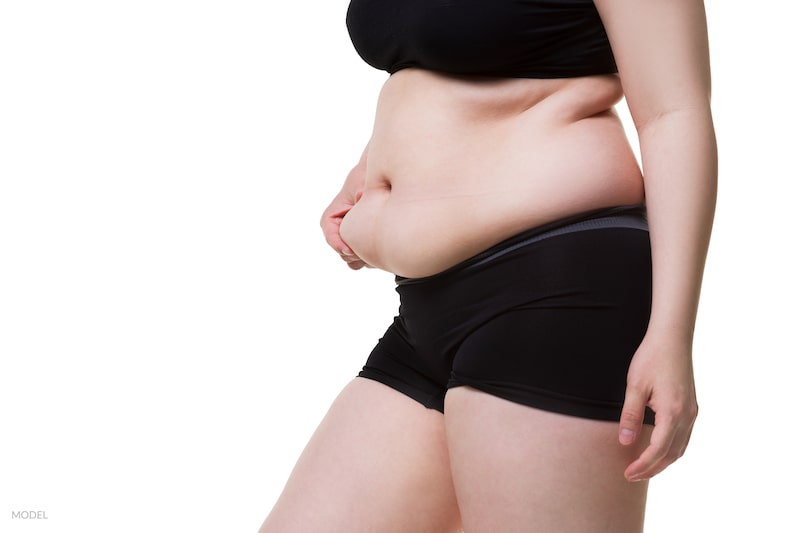 Why Should You Consider a Tummy Tuck? 4 Lesser-Known Facts About the Body Contouring Procedure - Featured Image