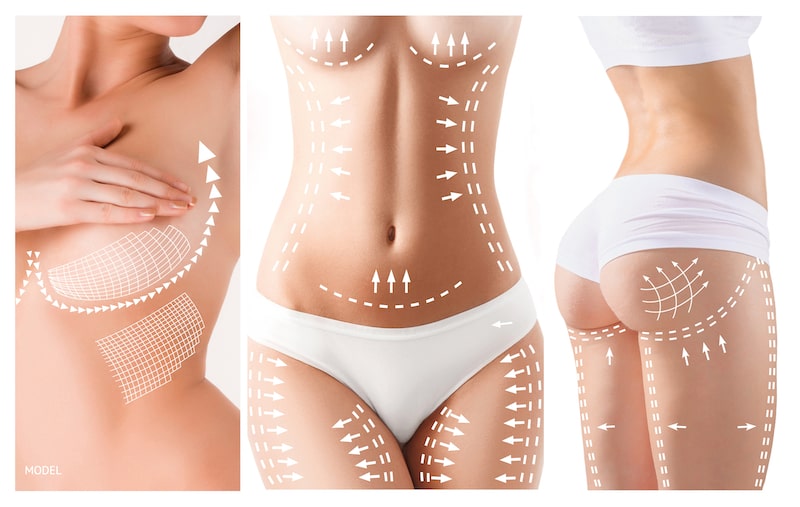 Three close-up images of woman's body with surgical lines. Images are of the breasts, abdomen, and buttocks.