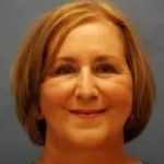 Facelift Before & After Patient #432
